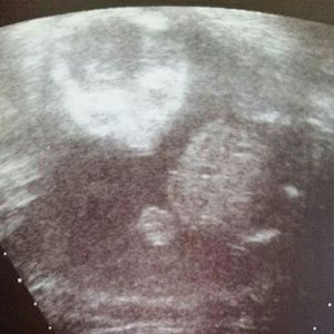 Meet your Posher, Marisol