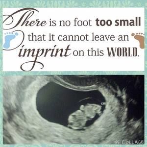 Meet your Posher, Mattie