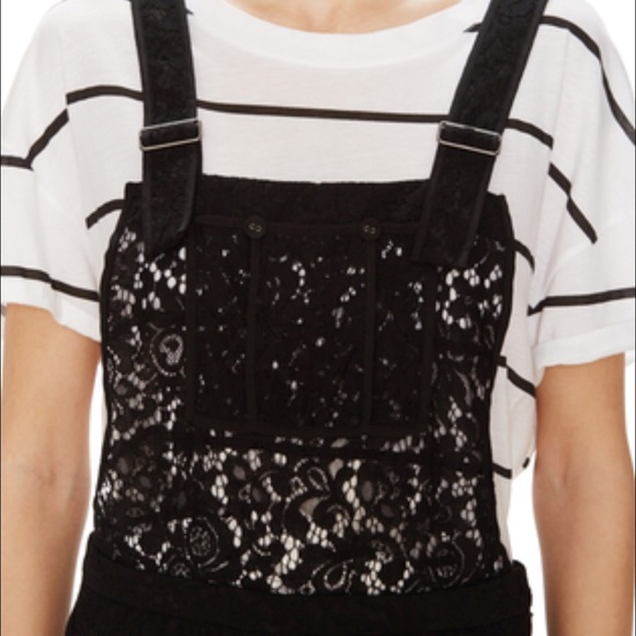 Lace short overall - Picture 3 of 4