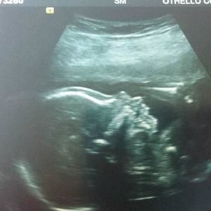 Meet your Posher, Blanca