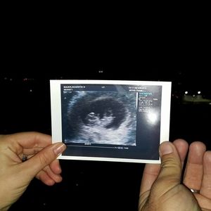 Meet your Posher, Dennis