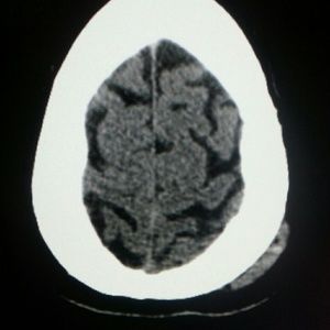 Meet your Posher, Ellen