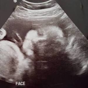 Meet your Posher, Aimee