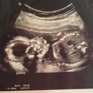 Meet your Posher, Markia