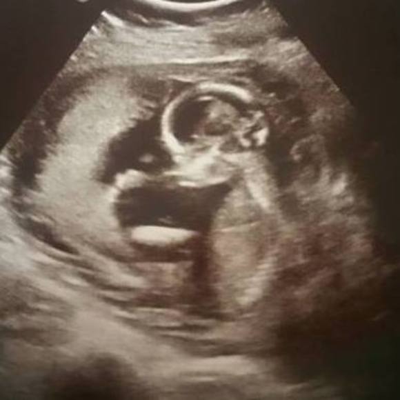 Meet your Posher, Rebecca - Picture 1 of 1