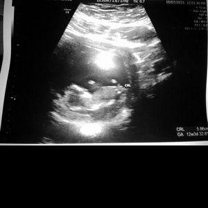 MY LIL BEAN