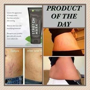 Stretch Mark Cream by It Works!
