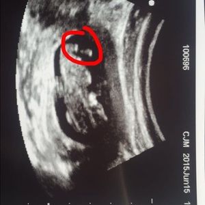 Meet your Posher, Marisol