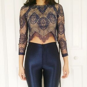 Lace top 💙