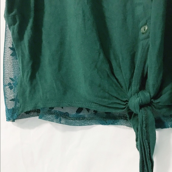Button up top - Picture 1 of 2