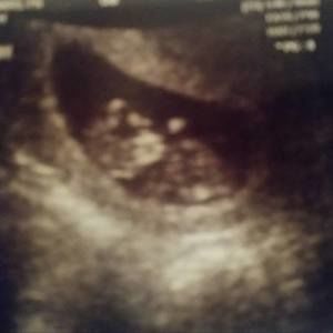 Meet your Posher, Marilyn