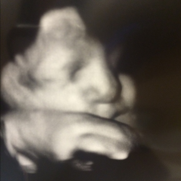 Meet your Posher, Thani - Picture 1 of 1