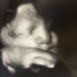 Meet your Posher, Thani