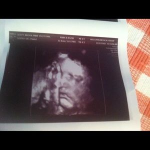 Meet your Posher, Brook