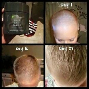 Hair, Skin, and Nails