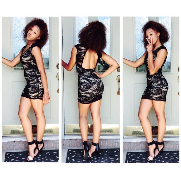 Black & Nude mini lace dress