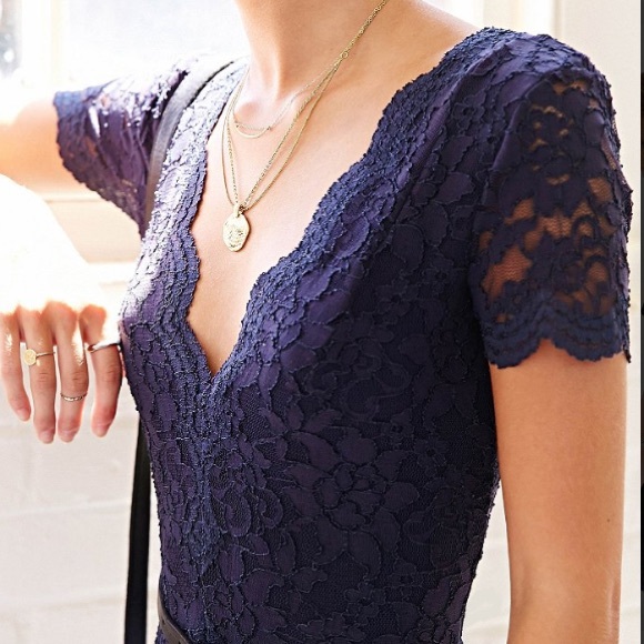 Urban Outfitters Kimchi Blue Scallop Lace Body Con - Picture 2 of 4