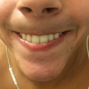 Meet your Posher, Rene