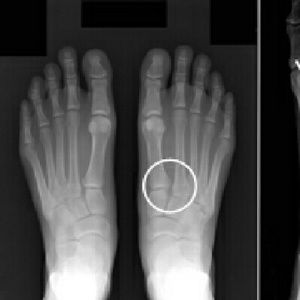 Meet your Posher, Curtis