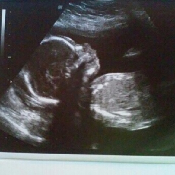 CLOSET CLOSED !!Baby #2 HELP