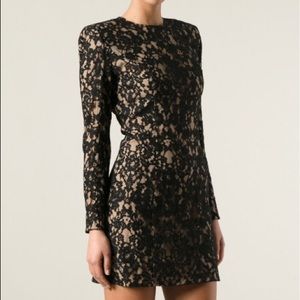beautiful lace dress
