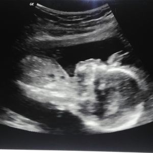 Meet your Posher, Molly