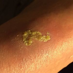 Meet your Posher, Lawrence