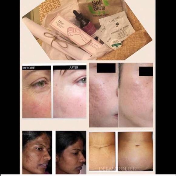 Derma roller kits
