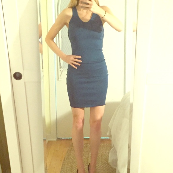 Teal blue Robert Rodriguez open back mini dress -2