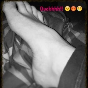 Broken foot 😕