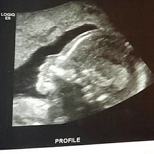 Meet your Posher, Lexii