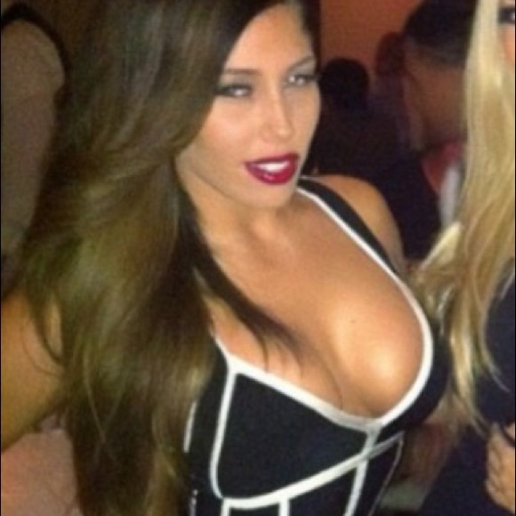 Herve Leger black and white mini dress