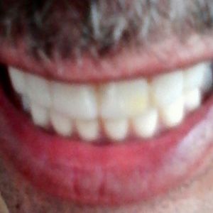 Meet your Posher, Al