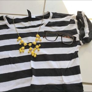 Black and White Striped Tunic