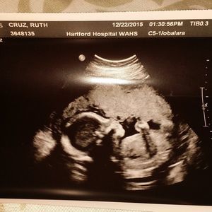 Meet your Posher, Ruth