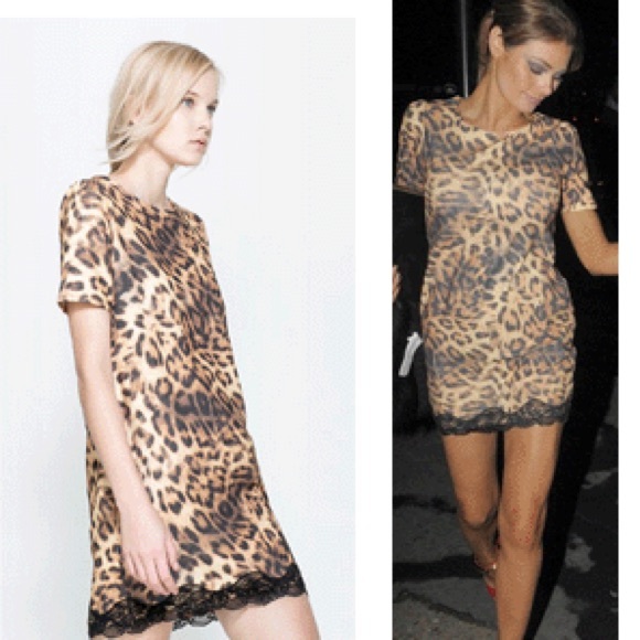 Leopard🔥 lace detail dress.