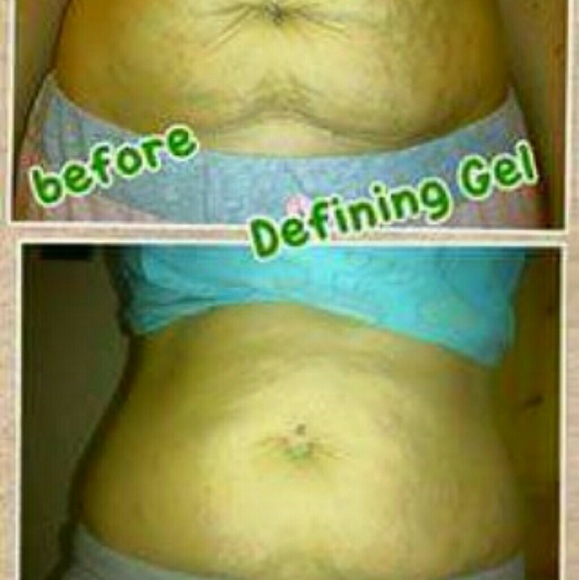 Defining Gel - Picture 2 of 3