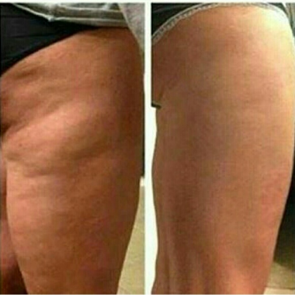 Defining Gel - Picture 3 of 3