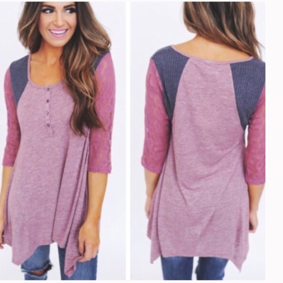 Tops - •baseball style tunic