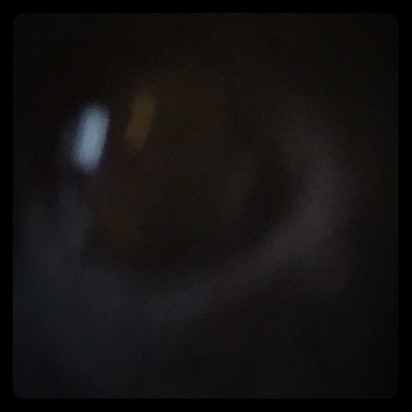 Dog eye