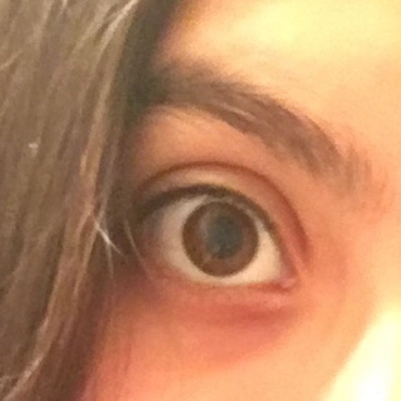 Human Eye