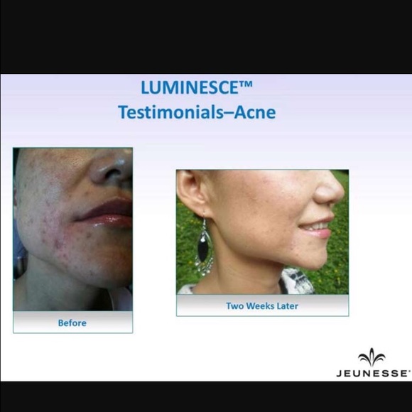 Luminesce Cellular Rejuvenation Serum - Picture 3 of 4