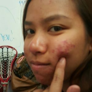 Meet your Posher, Angel