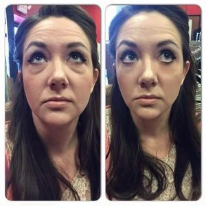 Instantly Ageless - 5 sachets