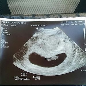 Meet your Posher, Deja