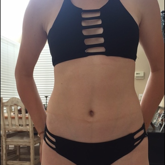acacia swimwear Other - Black bikini set