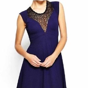French connection lace dress 2