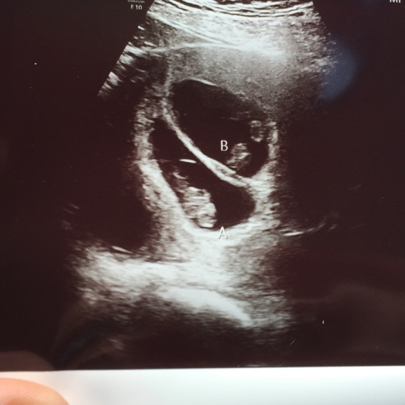 Meet your Posher, Nidia - Picture 3 of 16