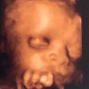 Meet your Posher, Yakeema