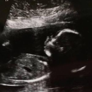 Meet your Posher, Lorrie